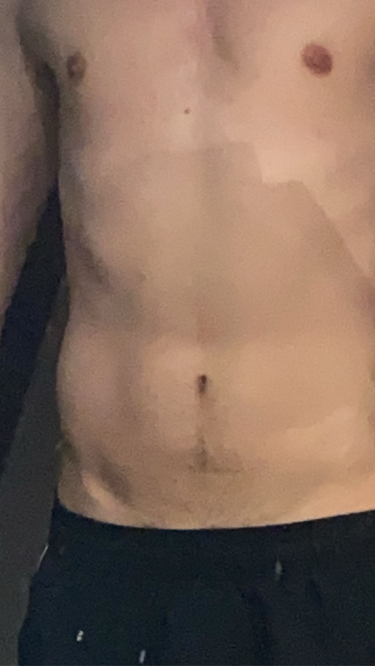 ptrix