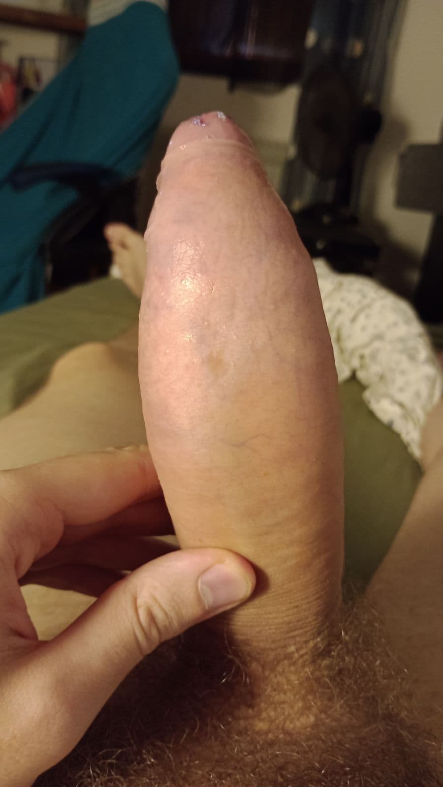 prp